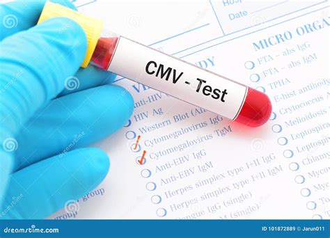 what is a cmv test